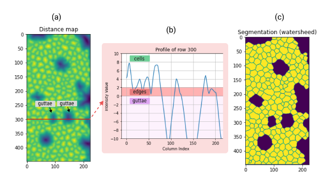 (a) Specular microscopy image. (b) Profile of row 300 from the distance map. (c) Final segmentation after applying watersheed transformation.