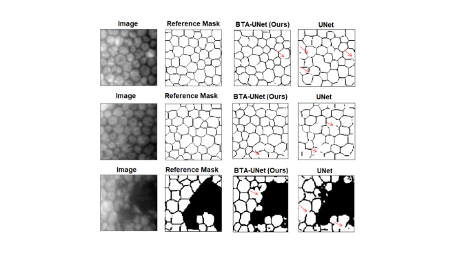 Segmentation results. The proposed method defines better the intercellular boundary of the segmentation, despite some problems due to non-uniform illuminated areas.
